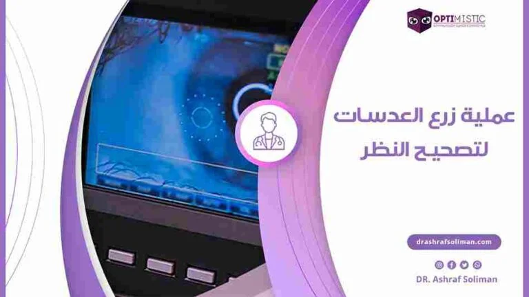 عملية زرع العدسات لتصحيح النظر