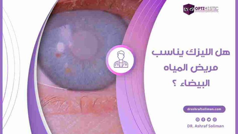 هل يمكن عمل الليزك بعد عملية المياه البيضاء
