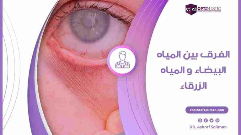 المياه البيضاء والمياه الزرقاء