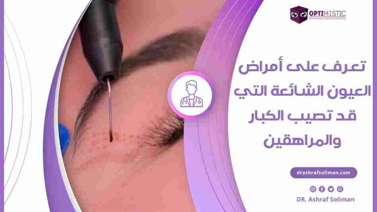 أمراض العيون الشائعة التي قد تصيب الكبار والمراهقين