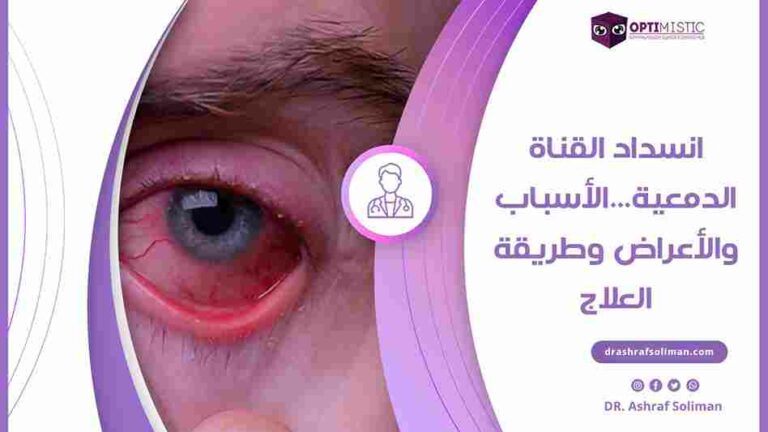 انسداد القناة الدمعية من التعريف والتشخيص للعلاج والمتابعة