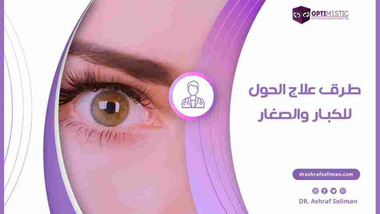 طرق علاج الحول للكبار والصغار
