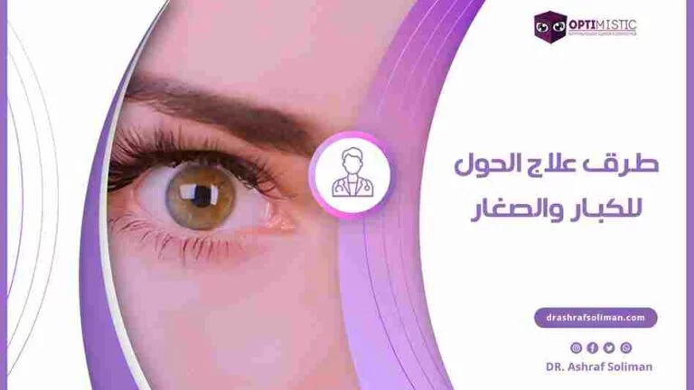 طرق علاج الحول للكبار والصغار