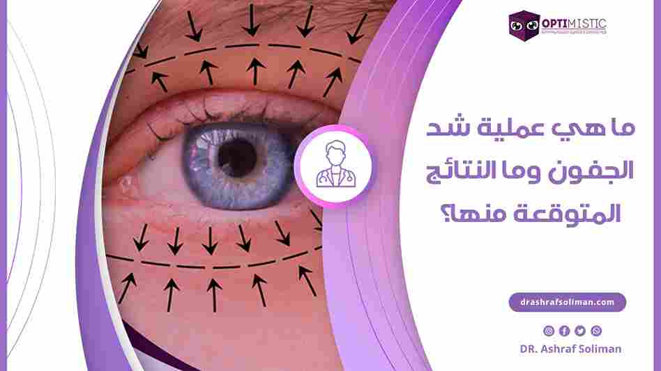 عملية شد الجفون