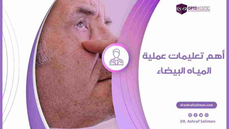 أهم تعليمات بعد عملية المياه البيضاء