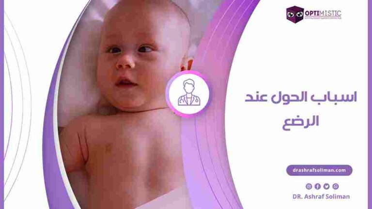 اسباب الحول عند الرضع