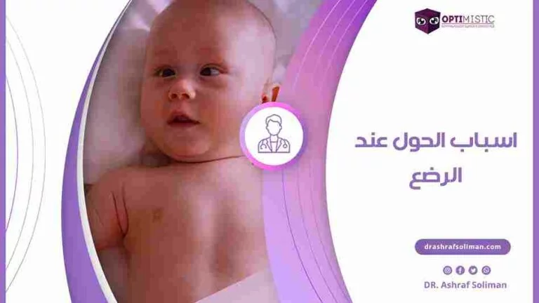 اسباب الحول عند الرضع