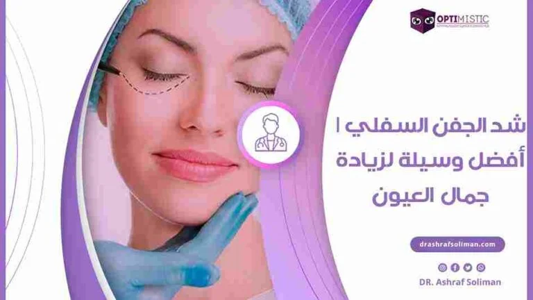 عملية شد الجفن السفلي للعين