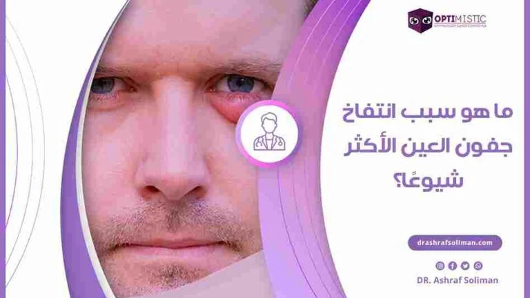 اسباب انتفاخ جفن العين العلوى