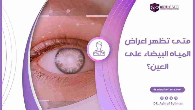 اعراض المياه البيضاء على العين