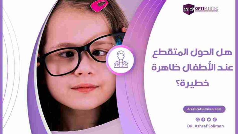 الحول المتقطع عند الأطفال