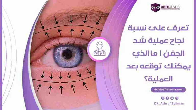 كم تبلغ نسبة نجاح عملية شد الجفن؟