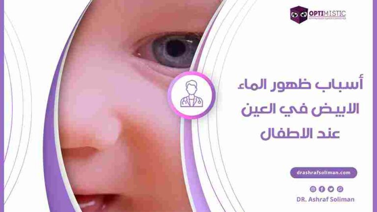 أسباب الماء الابيض في العين عند الاطفال