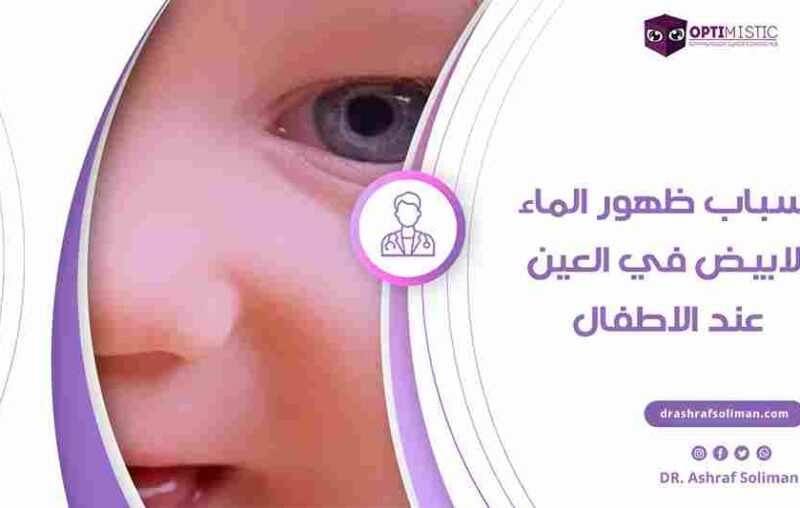 أسباب الماء الابيض في العين عند الاطفال