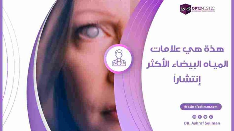 علامات المياه البيضاء في العين الأكثر إنتشاراُ