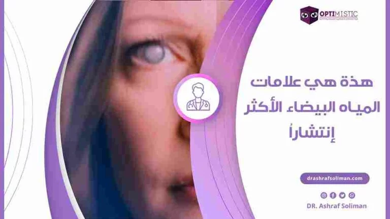 علامات المياه البيضاء في العين الأكثر إنتشاراُ
