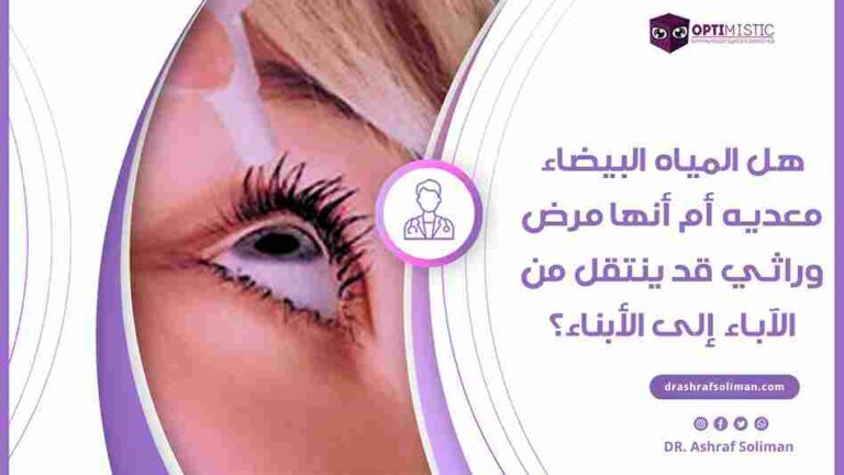 هل المياه البيضاء معديه