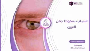 اسباب سقوط جفن العين