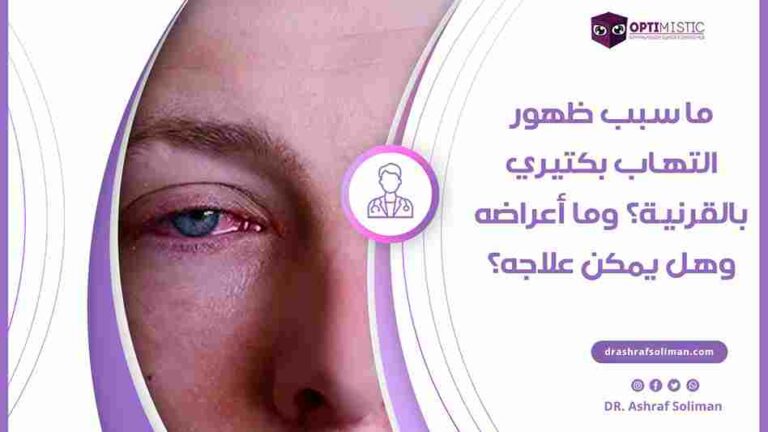 التهاب القرنية البكتيري : الاعراض، الاسباب والعلاج