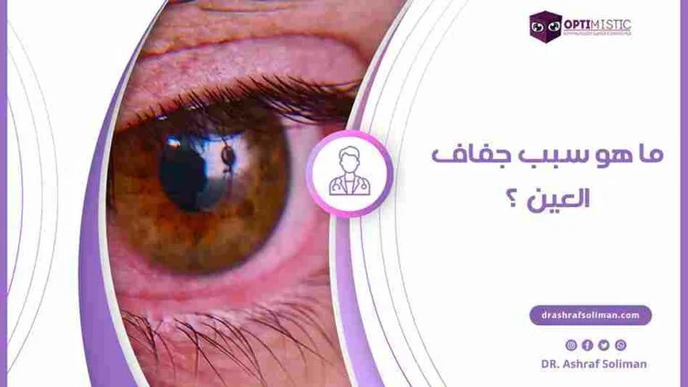 اسباب جفاف العين