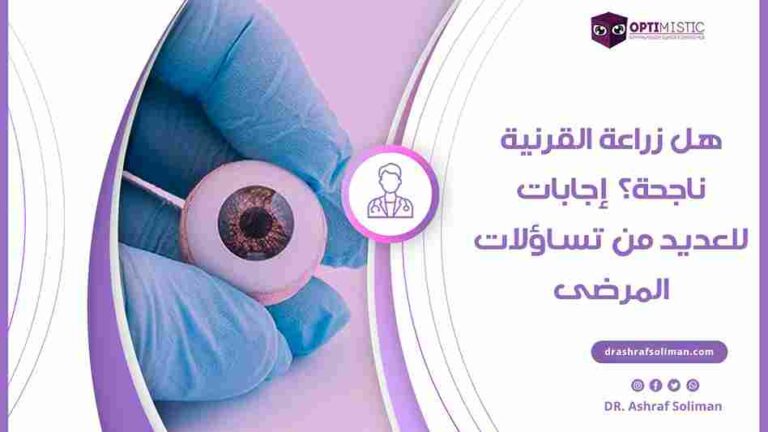 نسبة نجاح عملية زراعة القرنية