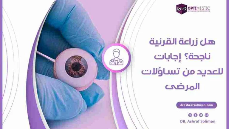 نسبة نجاح عملية زراعة القرنية