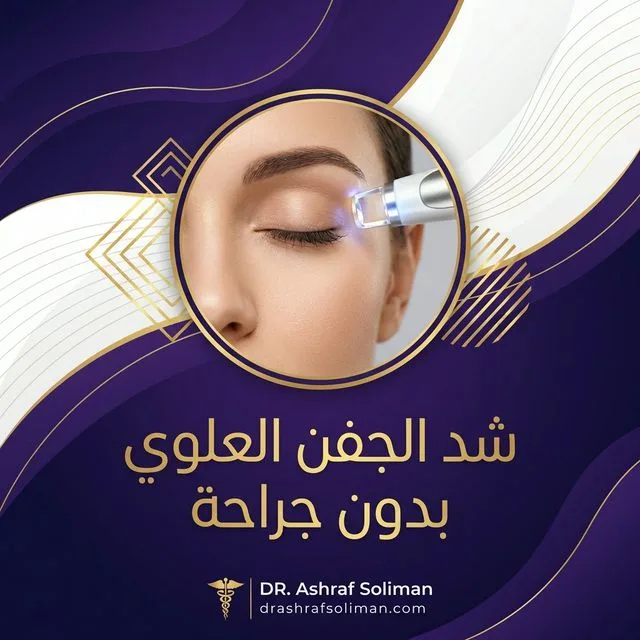 شد الجفن العلوي بدون جراحة