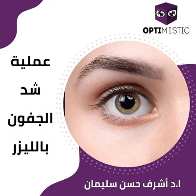 عملية شد الجفون