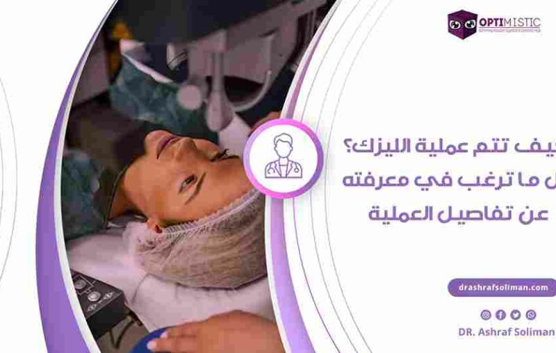 كيف تتم عملية الليزك