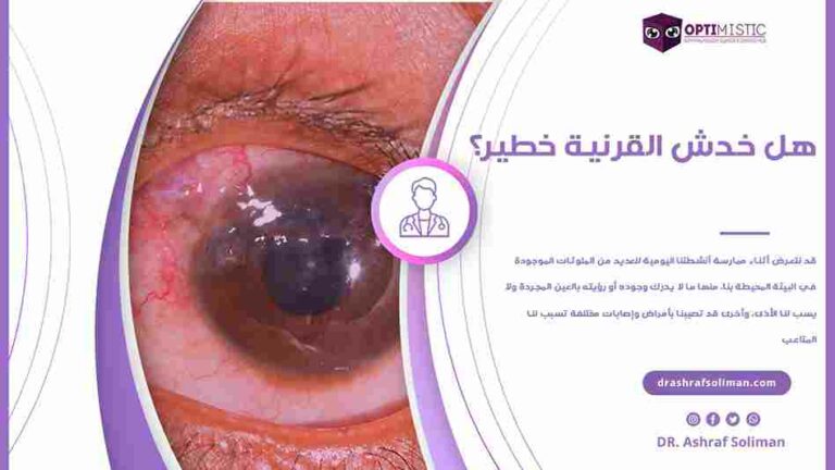 هل خدش القرنية خطير؟ إليك التفاصيل