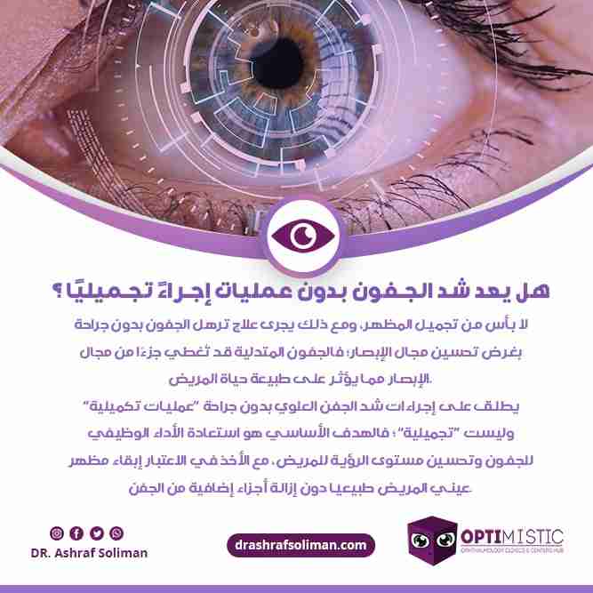 شد الجفن العلوي بدون جراحة