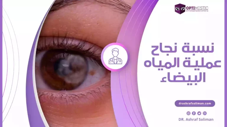 نسبة نجاح عملية المياه البيضاء