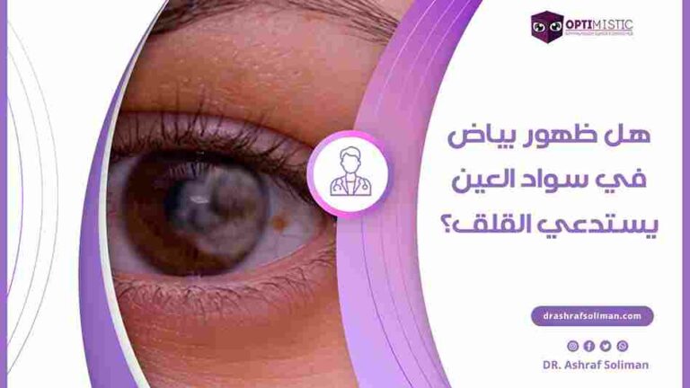 هل ظهور بياض في سواد العين يستدعي القلق؟