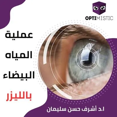 عملية المياه البيضاء بالليزر