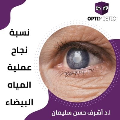 نسبة نجاح عملية المياه البيضاء