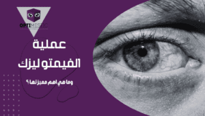 فيمتو ليزك