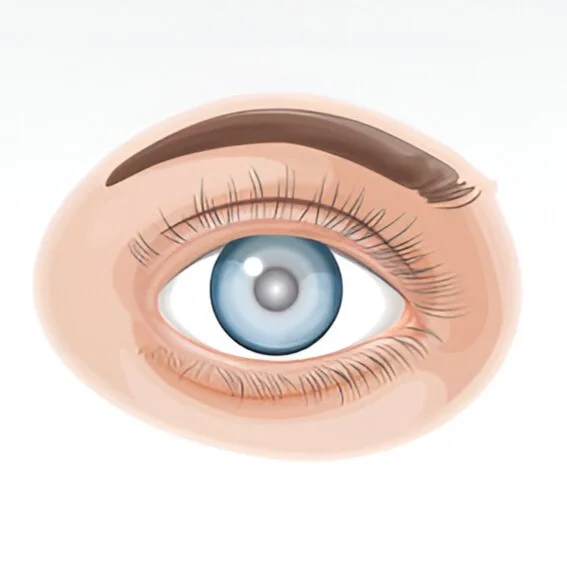 عملية المياه البيضاء