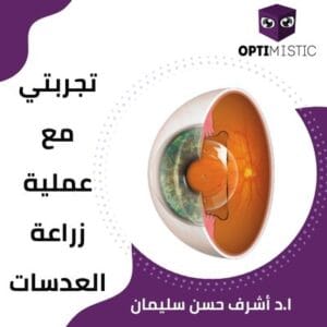 تجربتي مع عملية زراعة العدسات