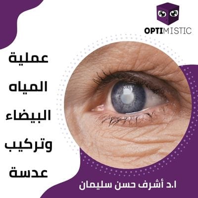 عملية المياه البيضاء وتركيب عدسة