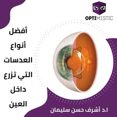 افضل انواع العدسات التي تزرع داخل العين