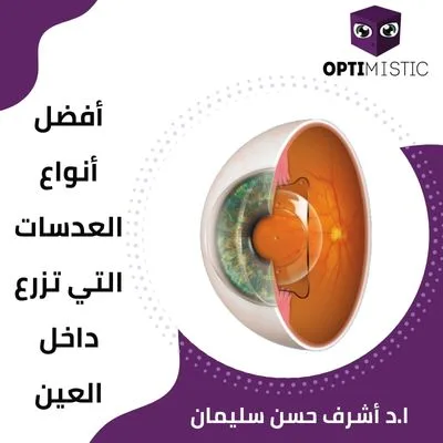 افضل انواع العدسات التي تزرع داخل العين