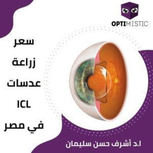 سعر زراعة عدسات icl في مصر