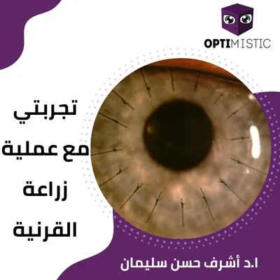 تجربتي مع زراعة القرنية