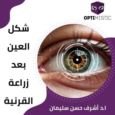 شكل العين بعد زراعة القرنية