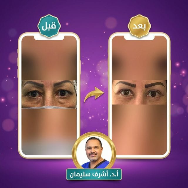 نتيجة سارة - قبل وبعد