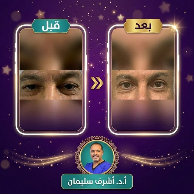 نتيجة هدى - قبل وبعد