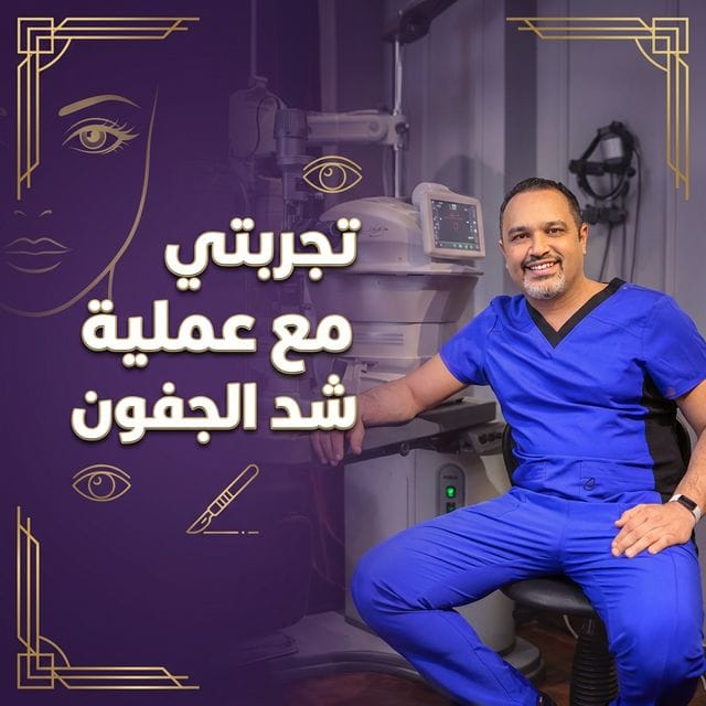 تجربتي مع عملية شد الجفون