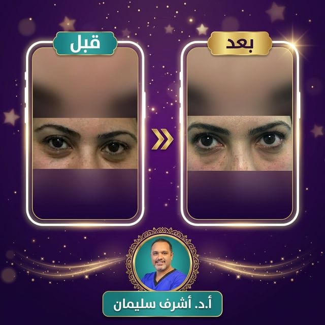 نتيجة نورهان - قبل وبعد