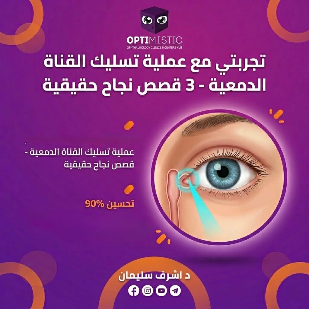 تجربتي مع عملية تسليك القناة الدمعية — 3 قصص نجاح حقيقية