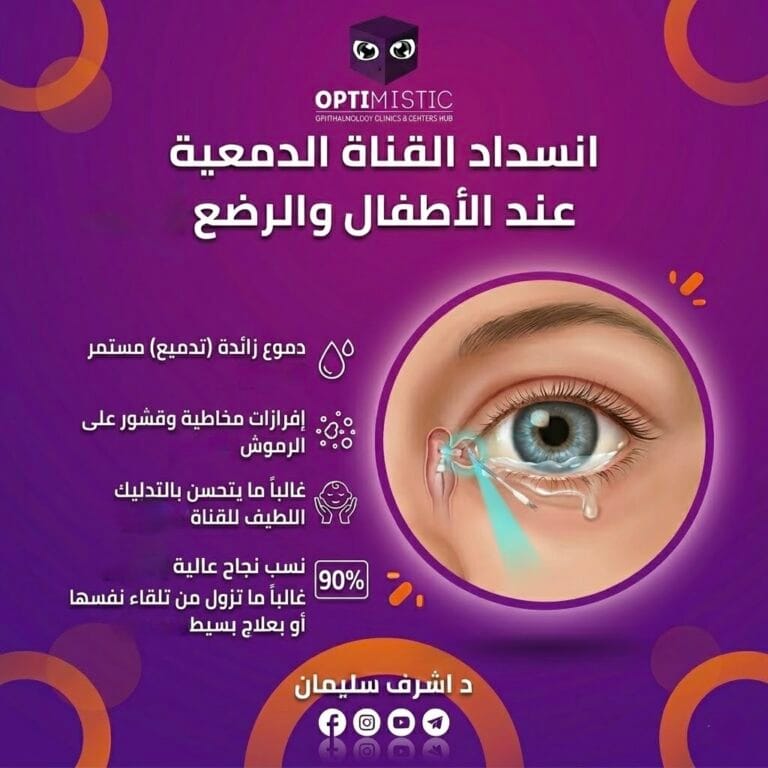 انسداد القناة الدمعية عند الأطفال